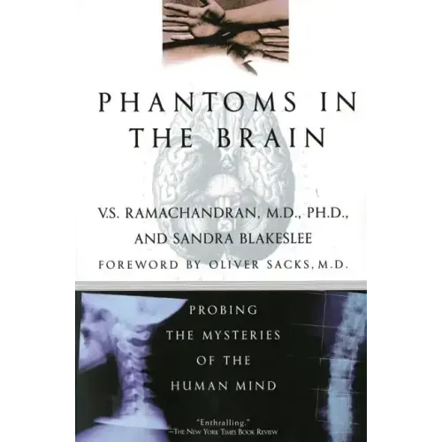 Phantoms in the Brain - Paperback
