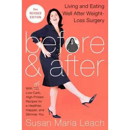 Before & After, Second Revised Edition: Living and Eating Well After Weight-Loss Surgery